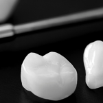 Implantes
