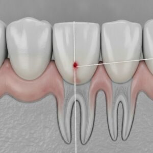 ¿Te sangra al usar seda dental? Descubre qué hay detrás